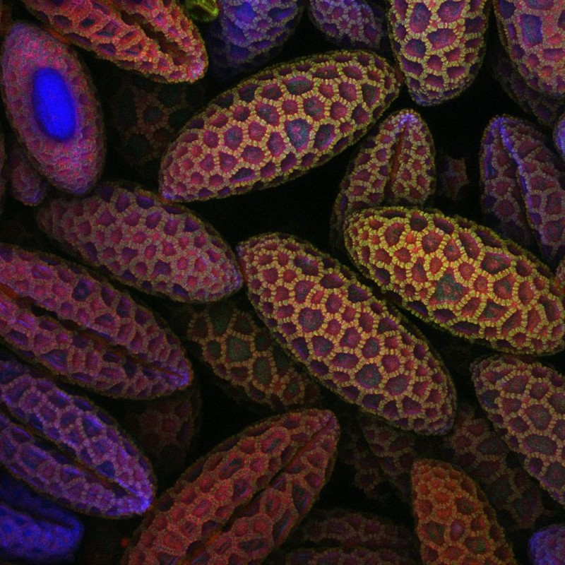 Микроскоп микрофотография. Микрофотографии Nikon small World 2017. Пыльца микрофотографии. Пыльца лилии в микроскоп. Мир под микроскопом.